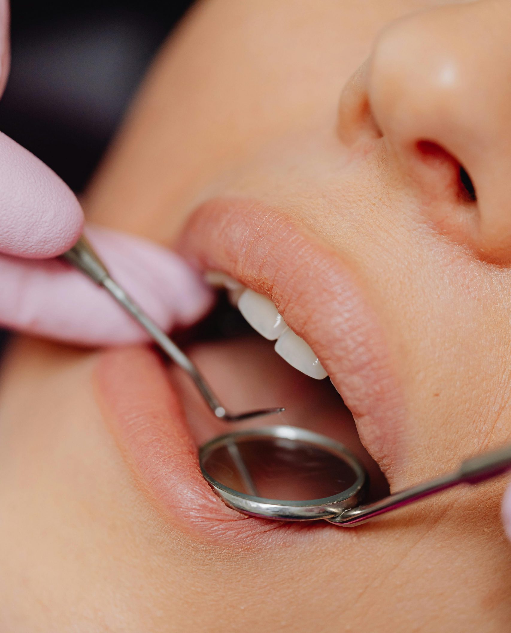 Close-up view of a patient's dental check-up using dental mirror and tools.